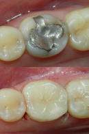 Los Angeles Cosmetic Dentist